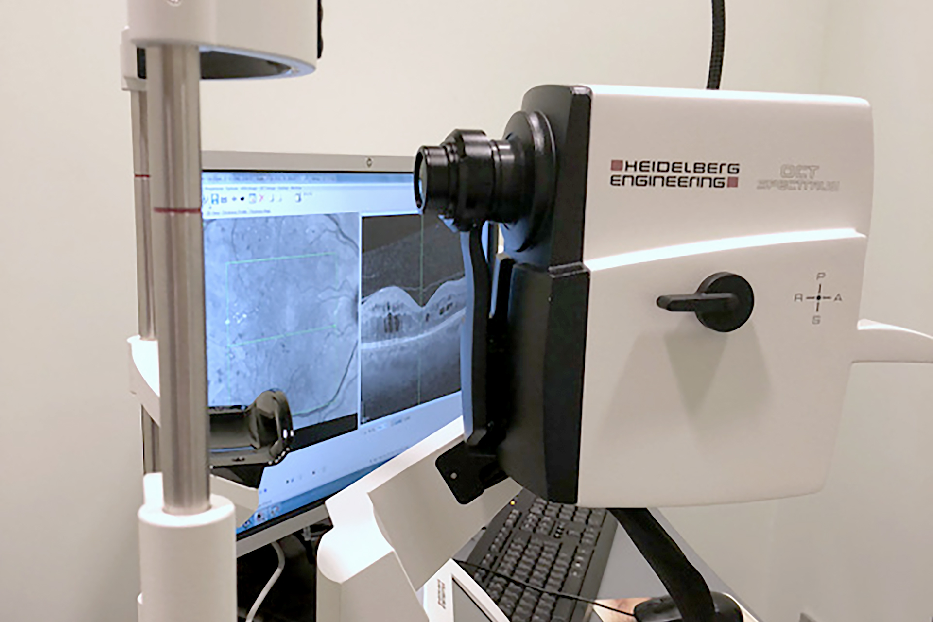 OCT – Tomografia de Coerência Óptica